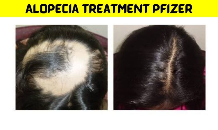 Pfizer Alopecia 2022 Drug